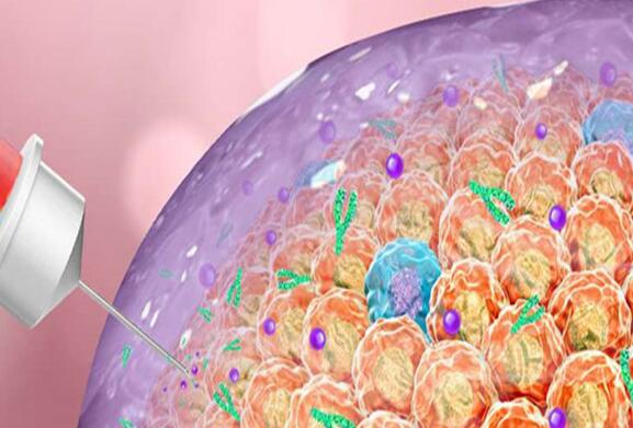 新实验|支架里装入化疗药，能减少化疗副作用和肿瘤复发率