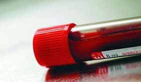 自身抗体检查都包括哪些？