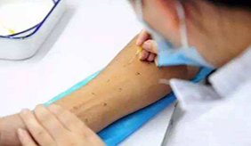 医生怎么进行过敏原特异性体内试验？