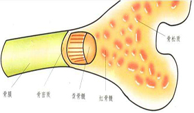 什么是骨髓增生异常综合征?