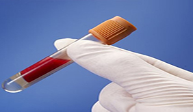 体检发现血脂高，也没有啥不舒服，如果不治疗会产生什么危害？