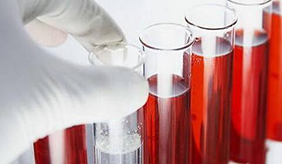 血脂高&血液黏稠是个大问题