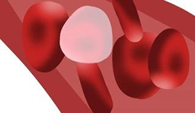 七种健康饮食有助于降血脂