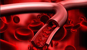 医生辟谣：想血管好，3件事是硬道理