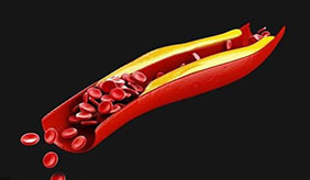 高血脂通过多吃某种食物能降下来吗？