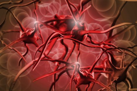 高血压肾病如何防治，看看指南怎么说！