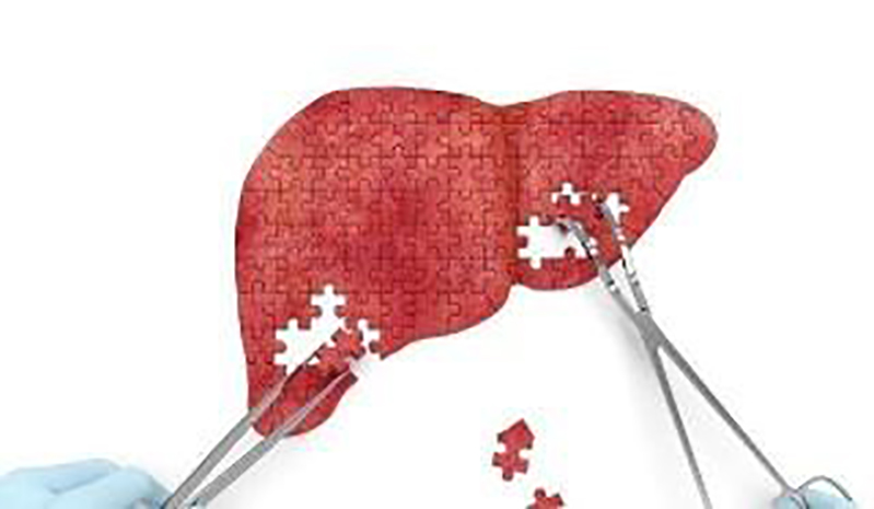 体检报告单中“转氨酶”偏高，意味着什么？