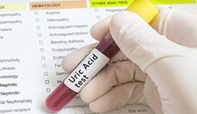 高尿酸和运动的关系，医生为你全面分析