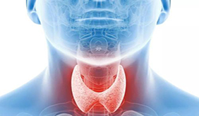 检出甲状腺结节很慌？四个认识误区要厘清