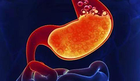 一条条对照,你是胃癌高危人群吗?