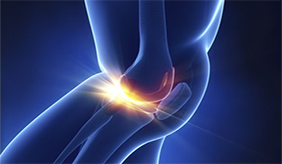 原来关节炎有这么多种！远离关节炎，现在就要保养起来