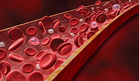 如何解读血脂检查的七项指标？