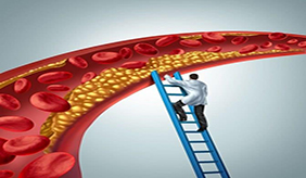 8种人血管里容易有垃圾，平时做好4件事，或能预防心血管病！