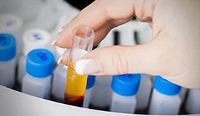 尿常规正常值怎么看，在这些范围就算达标