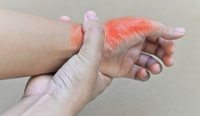 体内尿酸高，尿液或有4种变化？