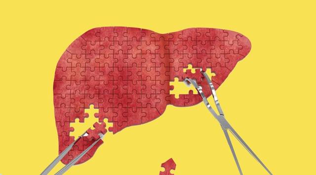 查出脂肪肝的人，这4个饮食习惯，要尽快改正，避免进一步发展