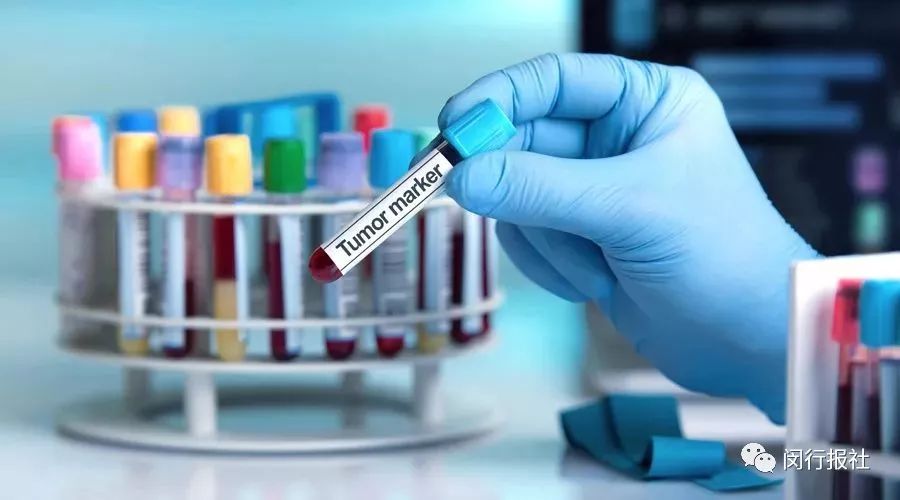 肿瘤标志物有必要查吗？