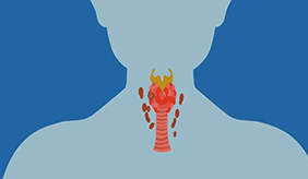 甲状腺结节与加碘盐有关吗？甲状腺结节患者，如何摄入碘？