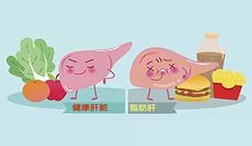 脂肪肝的人，这4个饮食习惯，要尽快改正，为什么会得脂肪肝？