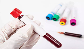 血液检查都查些什么？