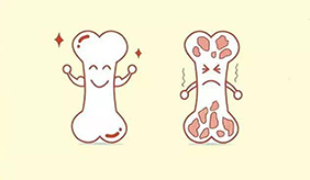 骨质疏松患者运动要科学