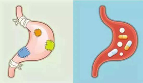 幽门螺杆菌科普来了，看完你就懂了！