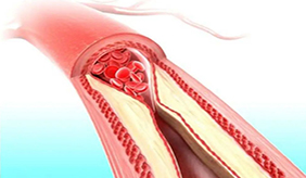 这些表现提示血管可能不健康，​如何让血管老化慢一些