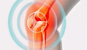 关于关节炎，你想知道的都在这！