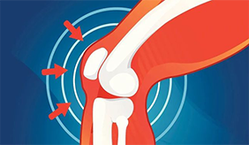 关节最怕哪5件事？