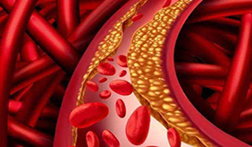 甘油三酯偏高和胆固醇偏高哪个更危险？