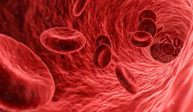 确诊脑血管硬化，别紧张，做好这5件事可有效稳定病情！ 