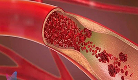 为什么血糖高的人，血脂也容易异常？