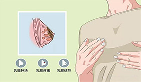 乳腺癌早期有信号，除了无痛肿块，还需留意5种异常