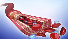 心血管不好的8大信号！做好这几点，远离心血管疾病困扰！