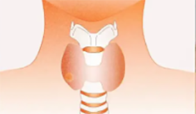 带你科学认识甲状腺结节